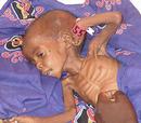 _freedomfry_org_images_pictures_darfur-starving_girl-2004-IRIN-Claire-McEvoy.jpg