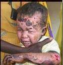 _villagevoice_com_blogs_bushbeat_archive_images_Darfur-baby-burnt-bombing-r.jpg