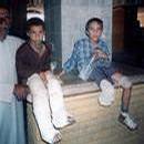 civilians_info_iraq_images_childrens_legs.jpg