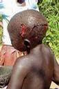 uganda_blogspirit_com_images_medium_child_wounded.5.jpg
